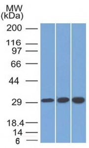 Western blot testing of human 1) 293, 2) Jurkat and 3) HepG2 cell lysate using SDHB antibody (clone 