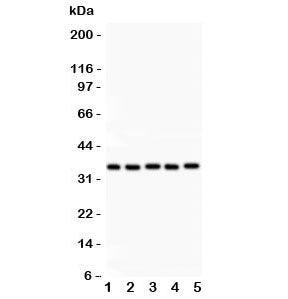 HOXA11 Antibody