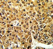 MLX Antibody / Max-like protein X