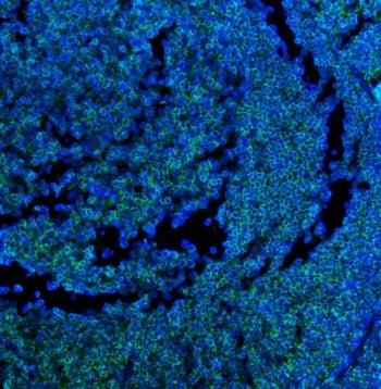 Immunofluorescent staining of FFPE human tonsil tissue with CD45 antibody (green) and DAPI nuclear s