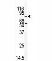 MARK2 Antibody (EMK)