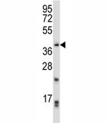 PITX2 Antibody