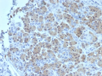 BRCA2 Antibody