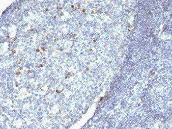 IHC: Formalin-fixed, paraffin-embedded human tonsil stained with anti-IgM antibody.