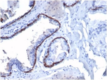 IHC staining of FFPE human prostate tissue with CK14 antibody (clone KRT14/4130) at 2ug/ml. HIER: bo