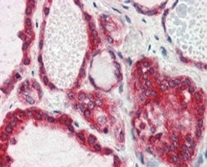 Lipin 3 Antibody