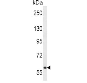 Tec Antibody