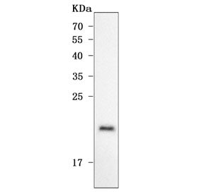 Western blot testing of human placental tissue lysate with ODAPH antibody. Predicted molecular weigh