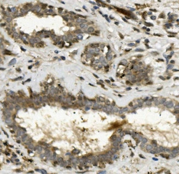 TEAD2 Antibody