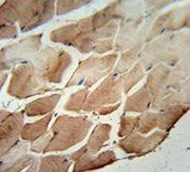 ACOT11 Antibody