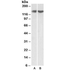 Western blot testing of HEK293 [A] and HeLa [B] lysate with REST antibody at 0.3ug/ml. Predicted mol
