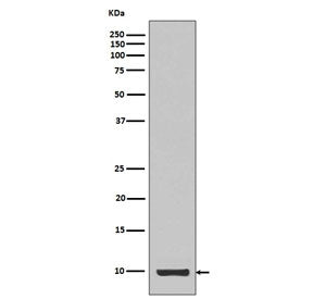 IGF-1 Antibody / Insulin like Growth Factor 1