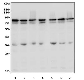 Western blot testing of human 1) U-87 MG, 2) HeLa, 3) MDA-MB-453, 4) PC-3, 5) A431, 6) Caco-2 and 7)