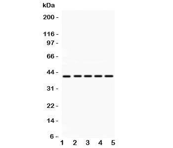 HOXA10 Antibody