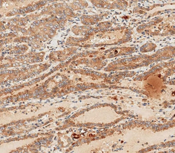 WNT5A Antibody