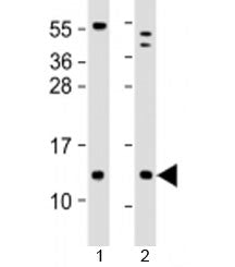 Western blot testing of human 1) human brain and 2) LNCaP cell lysate with C18orf32 antibody at 1:20