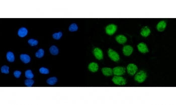 Immunofluorescent staining of FFPE human SiHa cells with CoREST antibody (green) and DAPI nuclear st