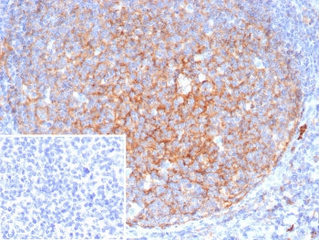 IHC staining of FFPE human spleen tissue with CD11b antibody (clone ITGAM/4741). Inset: PBS used in 