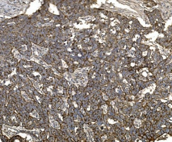 Claudin 3 Antibody / CLDN3