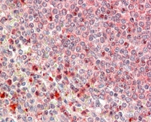 UBR4 Antibody