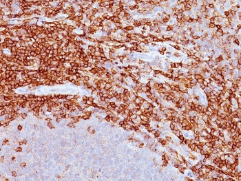 CD43 Antibody