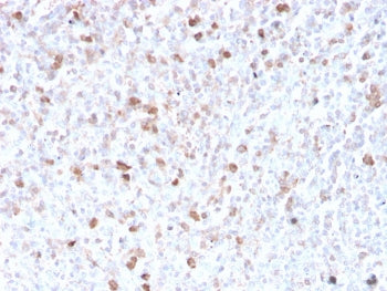 Lambda Light Chain Antibody / Lambda Antibody
