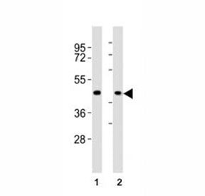 Western blot testing of CCR1 antibody at 1:2000 dilution. Lane 1: A375 lysate; 2: human skeletal mus
