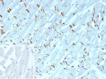 IHC staining of FFPE human heart tissue with Cadherin 2 antibody (clone CDH2/9489). Inset: PBS used 