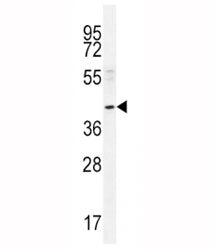 NEU2 Antibody