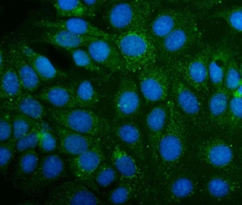 Immunofluorescent staining of FFPE human MCF7 cells with ABAT antibody (green) and DAPI nuclear stai