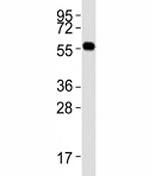 PRMT3 Antibody