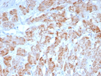 IHC staining of FFPE human smooth muscle tissue with SMMHC antibody (clone MYH11/8185R). HIER: boil 