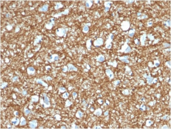 IHC testing of FFPE human brain with p14ARF antibody (clone 4C6/4). HIER: boil tissue sections in pH
