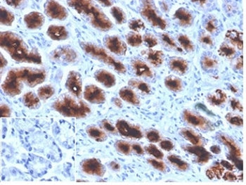 IHC staining of FFPE human stomach tissue with MUC1 antibody (clone Mc5). Negative control inset: PB