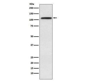 Western blot testing of human HeLa cell lysate with CRM1 antibody. Predicted molecular weight ~123 k