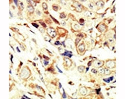 IGF1 Receptor Antibody (IGF1R)