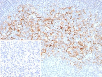 IHC staining of FFPE human tonsil tissue with CD23 antibody (clone FCER2/8510R). Inset: PBS used in 