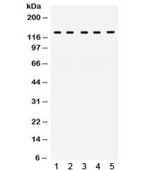 Western blot testing of human 1) HeLa, 2) 22RV1, 3) SW620, 4) A549 and 6) A431 cell lysate with TRPM