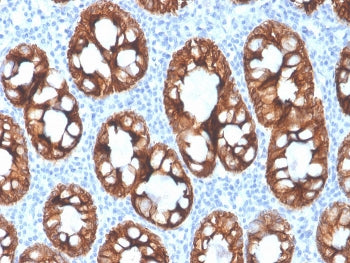 IHC staining of FFPE human colon with recombinant Cytokeratin 8 antibody (clone rKRT8/4209). HIER: b