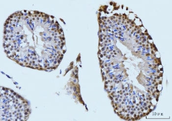 IHC staining of FFPE mouse testis tissue with SBNO1 antibody. HIER: boil tissue sections in pH8 EDTA