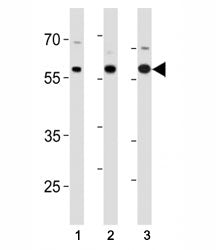 p65 Antibody (RELA)