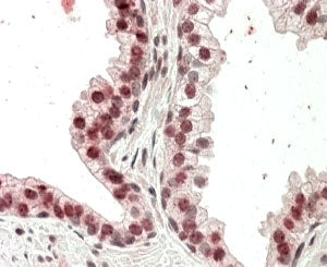HOXD13 Antibody