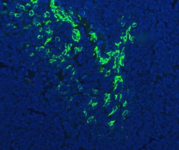 FDCSP Antibody