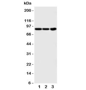 Western blot testing of TrkA antibody and Lane 1: COLO320; 2: HT1080; 3: U87 cell lysate. Observed m