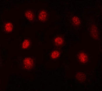 MAX Antibody / MYC associated factor X