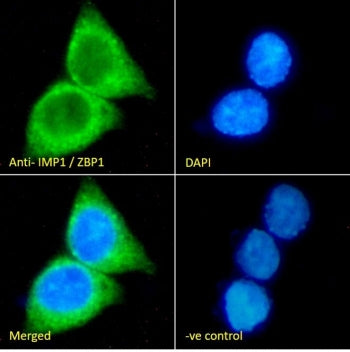 ZBP-1 Antibody / IGF2BP1
