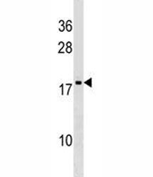 DR1 Antibody (Down-regulator of transcription 1)