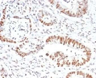 IHC staining of FFPE human colon tissue with MSH2 antibody (clone MSH2/6852). HIER: boil tissue sect