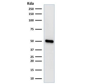 Western blot testing of human HeLa cell lysate with FOXA1 antibody (clone FOXA1/1518). Predicted mol