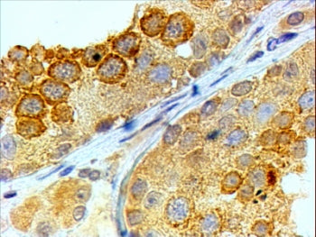 IHC testing of FFPE human testis with BOULE antibody at 4ug/ml. HIER: steamed with pH6 citrate buffe